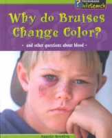 Why_do_bruises_change_color_